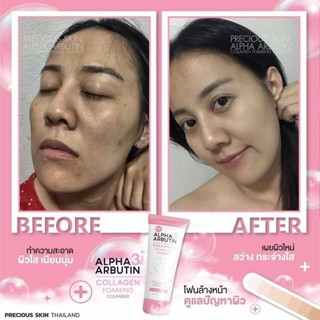 Sữa Rửa Mặt Alpha Arbutin 120ml - Nhập Thái
