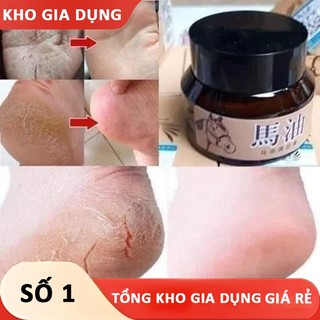 Kem cao ngựa tri nứt nẻ gót chân,tay, bôi nứt nẻ gót chân cao ngựa, nứt gót chân - GD Giá Rẻ