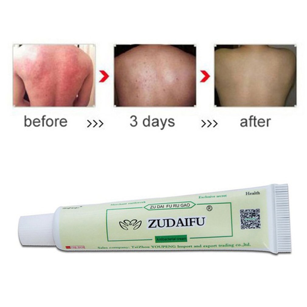 Thuốc Mỡ Thảo Dược Kháng Khuẩn zudaifu
