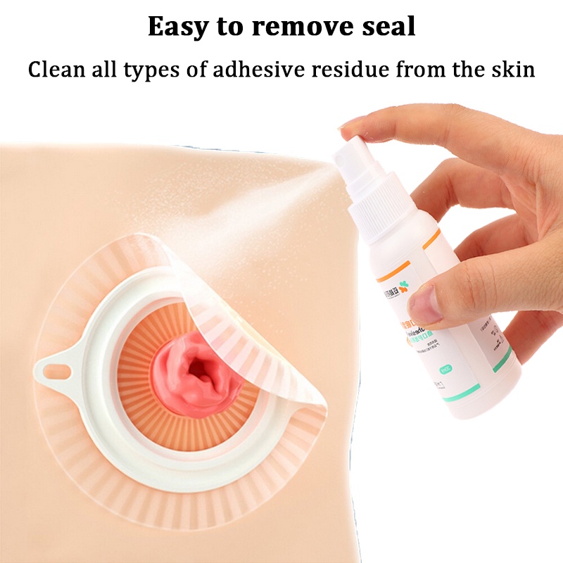 Ostomy Chai Xịt Loại Bỏ Keo Dán Chăm Sóc Sức Khỏe 30ml