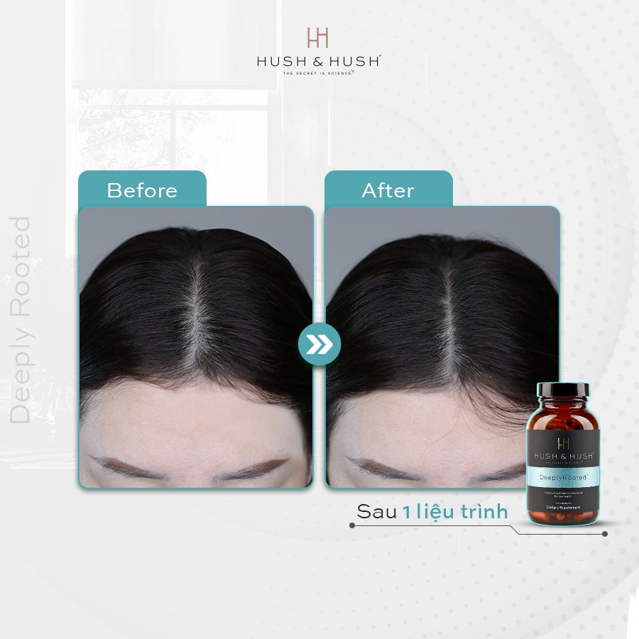 Viên Uống Tăng Cường Dinh Dưỡng Cho Tóc, Phục Hồi & Giảm Rụng Hush & Hush Deeply Rooted 120 viên