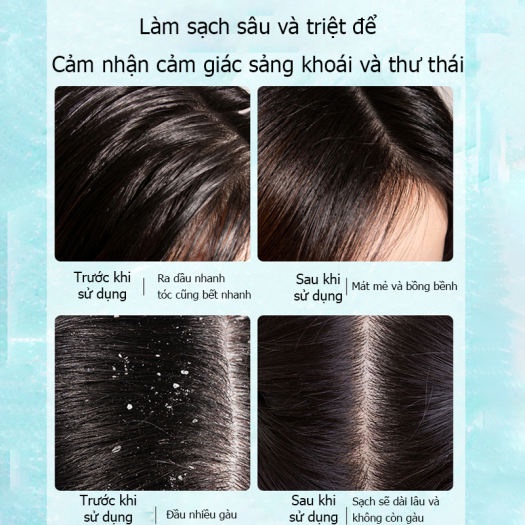 Cặp Dầu Gội Xả Đầu Thảo Mộc Gừng Tươi SILU Loại Bỏ Bết Tóc, Ngăn Ngừa Rụng Tóc, Kích Thích Mọc Tóc Bồng Bềnh, Làm Sạch S