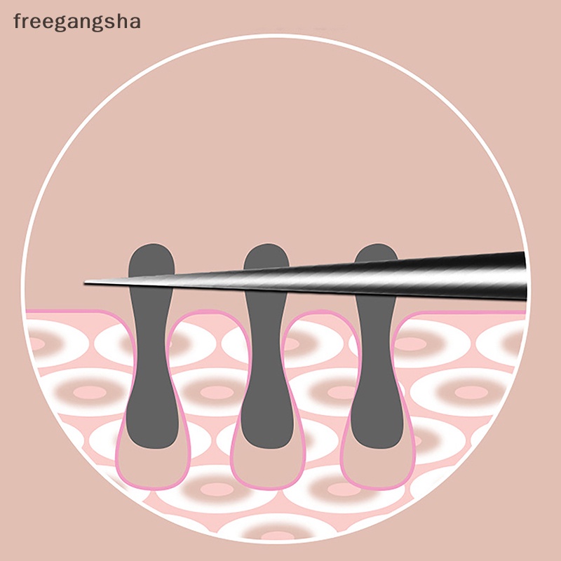 Nhíp 8cm Chuyên Dụng Cho Lấy Mụn Đầu Đen Làm Đẹp fdh