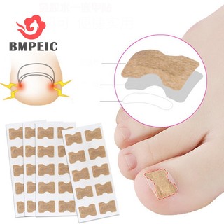 Set 10 miếng dán định hình móng chân mọc ngược mới