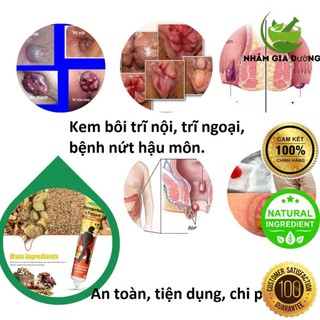Kem bôi trĩ, nứt hậu môn, thành phần thảo dược an toàn_hbesty