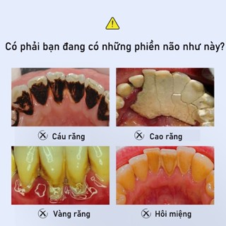 Kem Đánh Răng Làm Trắng Răng loại bỏ cao răng hôi miệng tẩy ố vàng Không