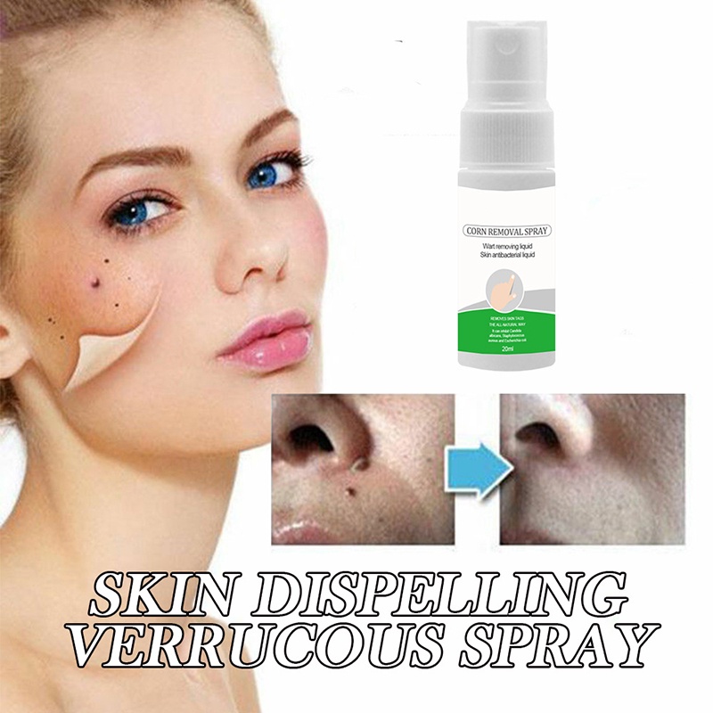 Xịt Tẩy Mụn Thịt Dư Trên Cơ Thể 0.7 oz Tại Nhà