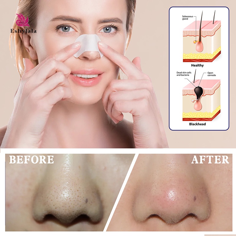 Bộ 6 Mặt Nạ Lột Mụn Đầu Đen Mũi Làm Sạch Sâu Se Khít Lỗ Chân Lông Chăm Sóc Da Hiệu eshylala Dành Cho Nam Và Nữ