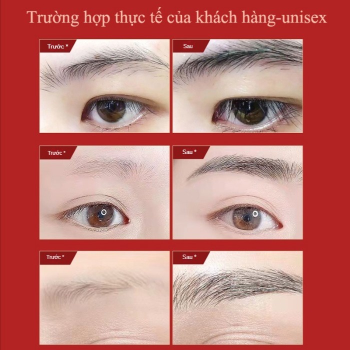 Serum mọc lông mày tinh chất kích mọc lông mày, lông mi,lông râu,mọc tóc,thúc đẩy lông mày dày và dài