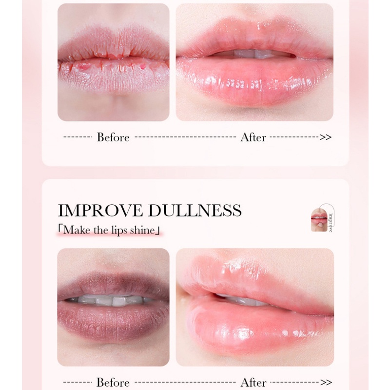 Sadoer Son Môi Dâu Tây / blueberry / Hoa Cúc Dưỡng Ẩm Cải Thiện Tình Trạng Khô Môi 7g