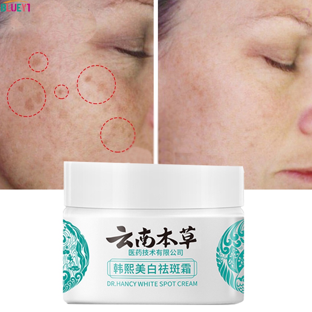 20G Kem Trị Nám Vân Nam Thảo Dược Làm Trắng Da Tàn Nhang Kem Thâm Chân Cường Trắng Da Hiệu Quả Trị Nám Pekas Tẩy Bluey1