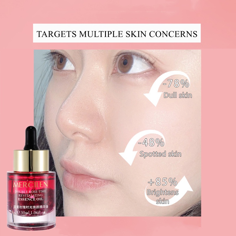 Mercilen Tinh Dầu Hoa Hồng 30ml Giúp Xóa Nếp Nhăn Nâng Cơ Và Làm Săn Chắc Da