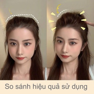 SET 2 Kẹp phồng chân tóc - FAIRY DIARY