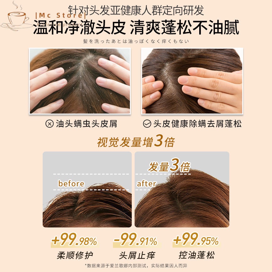 Vetes Dầu Gội / gel Tắm / Sữa Tắm / Dầu Xả Chống Gàu / Ngứa / Kiểm Soát Dầu / Lâu Trôi / Làm Sạch Sâu / Chăm Sóc Da