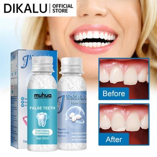 Nhựa tạm thời răng thay thế chất liệu tự làm răng sửa chữa nha khoa răng giả chắc chắn keo răng giả ma cà rồng răng keo 30ml beautysecret1