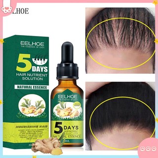 ✅cod eelhoe tinh dầu gừng tinh dầu mọc tóc chống rụng tóc tinh chất dưỡng tóc 5 ngày tinh chất mầm tăng trưởng chăm sóc tóc 30ml