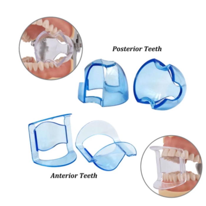Dụng Cụ Mở Miệng Bên Trong Răng Miệng
