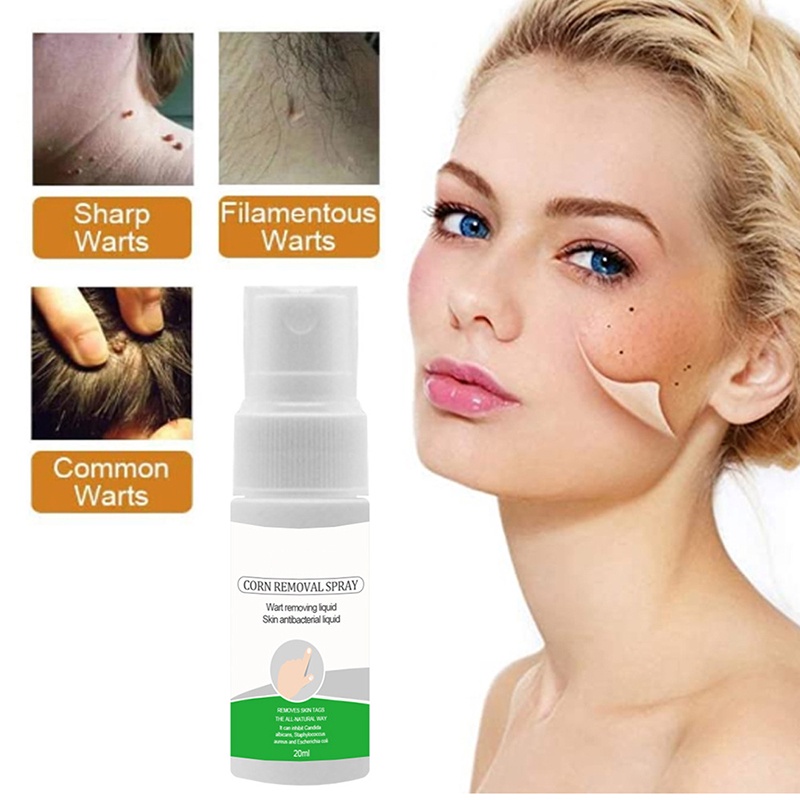 Xịt Tẩy Mụn Thịt Dư Trên Cơ Thể 0.7 oz Tại Nhà