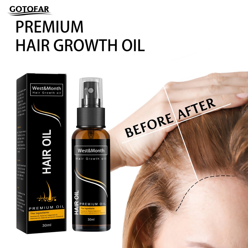 Tinh Dầu Kích Thích Mọc Tóc Tại Nhà 30ml