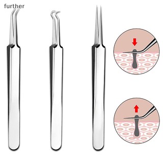 Nhíp kẹp 8cm chuyên dụng cho lấy mụn đầu đen làm đẹp