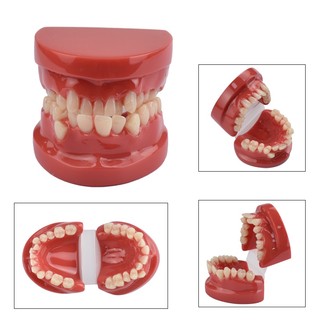 Mô Hình Hàm Răng 3d Bằng Nhựa resin