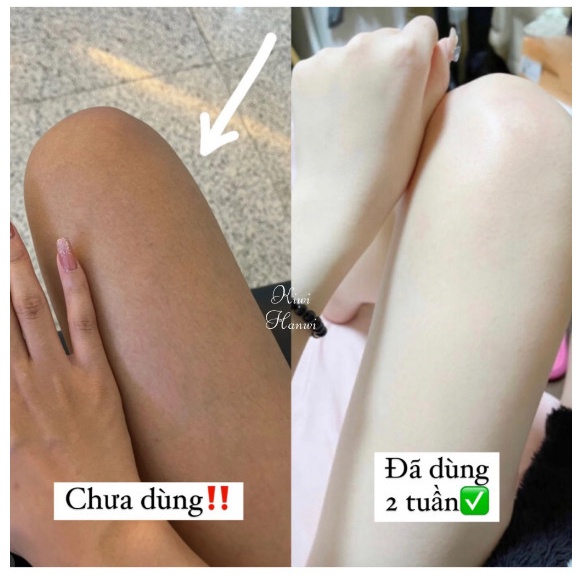 Kích Trắng Toàn Thân Siêu Trắng Vaseline 70x Đỏ