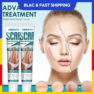 Chăm sóc da mặt 20g Gel trị sẹo Health amp Beauty 3-12cm Kem trị rạn da Sản chăm sóc da Kem chăm sóc sẹo đa năng Kem phục hồi sẹo blackpink11