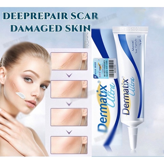 coza Dermatix Ultra Gel Làm mờ sẹo thâm và sẹo lồi