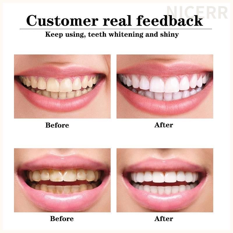 Kem Đánh Răng Chứa Bạc Hà Khô Xơ Làm Sáng Răng Chống Ẩm