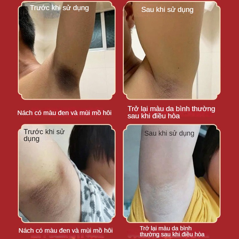 Xịt Khử Mùi Hôi Toàn Thân Chống Mồ Hôi Cho Nam Nữ