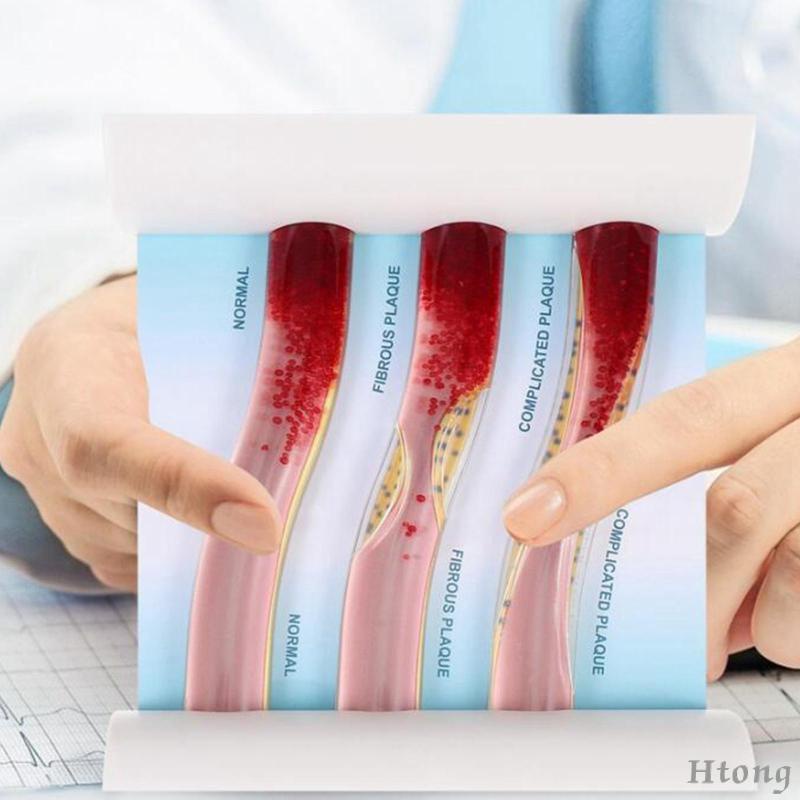 Vesel Mô Hình Bộ Xương Môi Tương Phản lipoprotein cardiovascular dynamic lipid Dùng Dạy Học