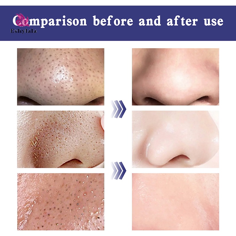 Bộ 6 Mặt Nạ Lột Mụn Đầu Đen Mũi Làm Sạch Sâu Se Khít Lỗ Chân Lông Chăm Sóc Da Hiệu eshylala Dành Cho Nam Và Nữ