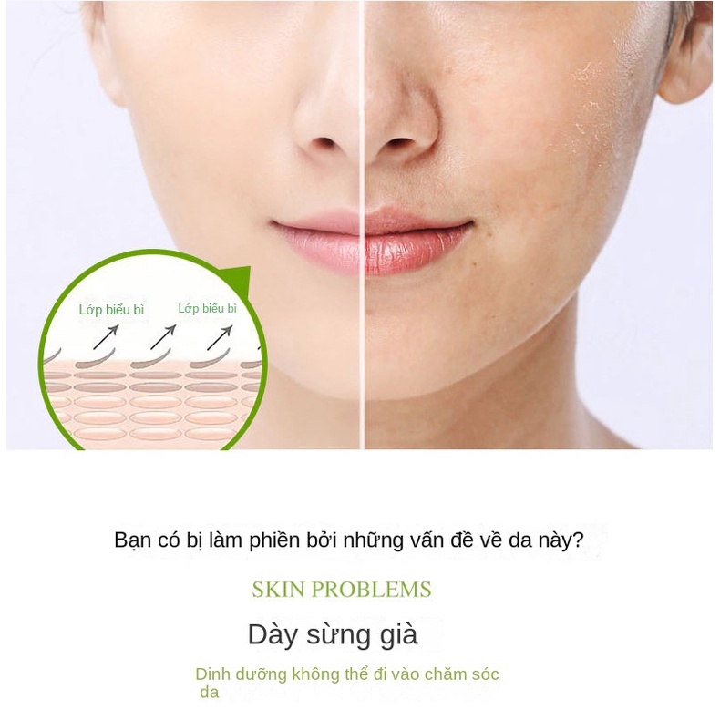 Gel Tẩy Tế Bào Chết 100g Chiết Xuất Lô Hội Làm Sạch Sâu Cho Da Mặt Và Toàn Thân