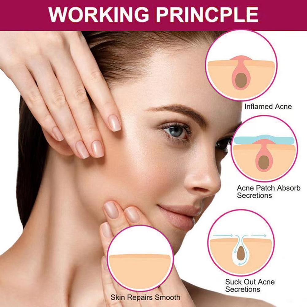 Miếng Dán Hỗ Trợ Giảm Mụn Chăm Sóc Da Mặt Chống Thấm Nước