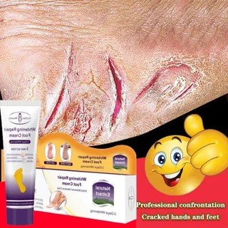 Whitening repair foot cream Kem Dưỡng Da Chân Hỗ Trợ Giảm Nứt Làm Trắng Và Bảo Vệ Gót Chân Hiệu Quả/Foot care100ML
