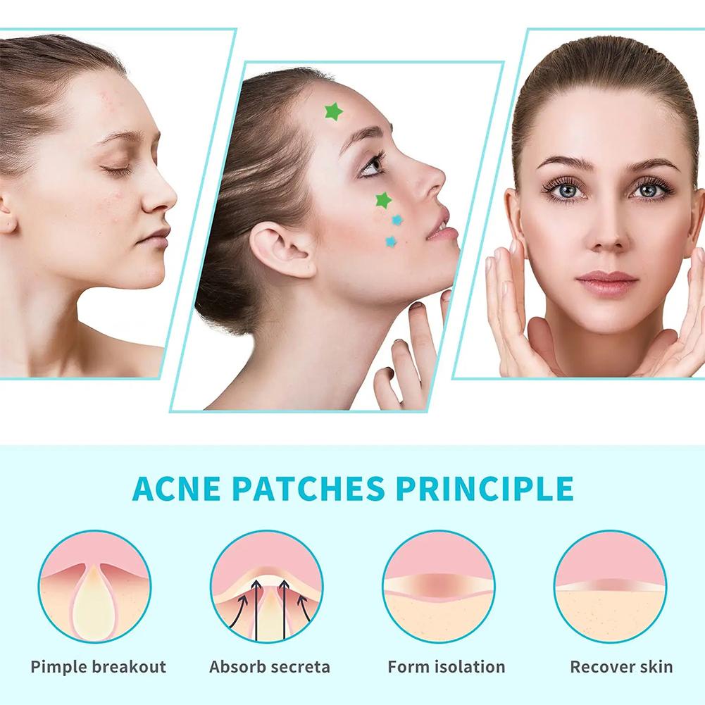 Miếng Dán Hỗ Trợ Giảm Mụn Chăm Sóc Da Mặt Chống Thấm Nước