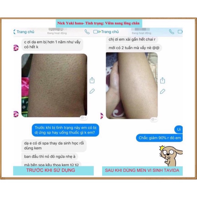 Xịt lợi khuẩn Bio Skin - Men xịt đánh bay mụn lưng, viêm nang lông tư Nhật Bản | BigBuy360 - bigbuy360.vn