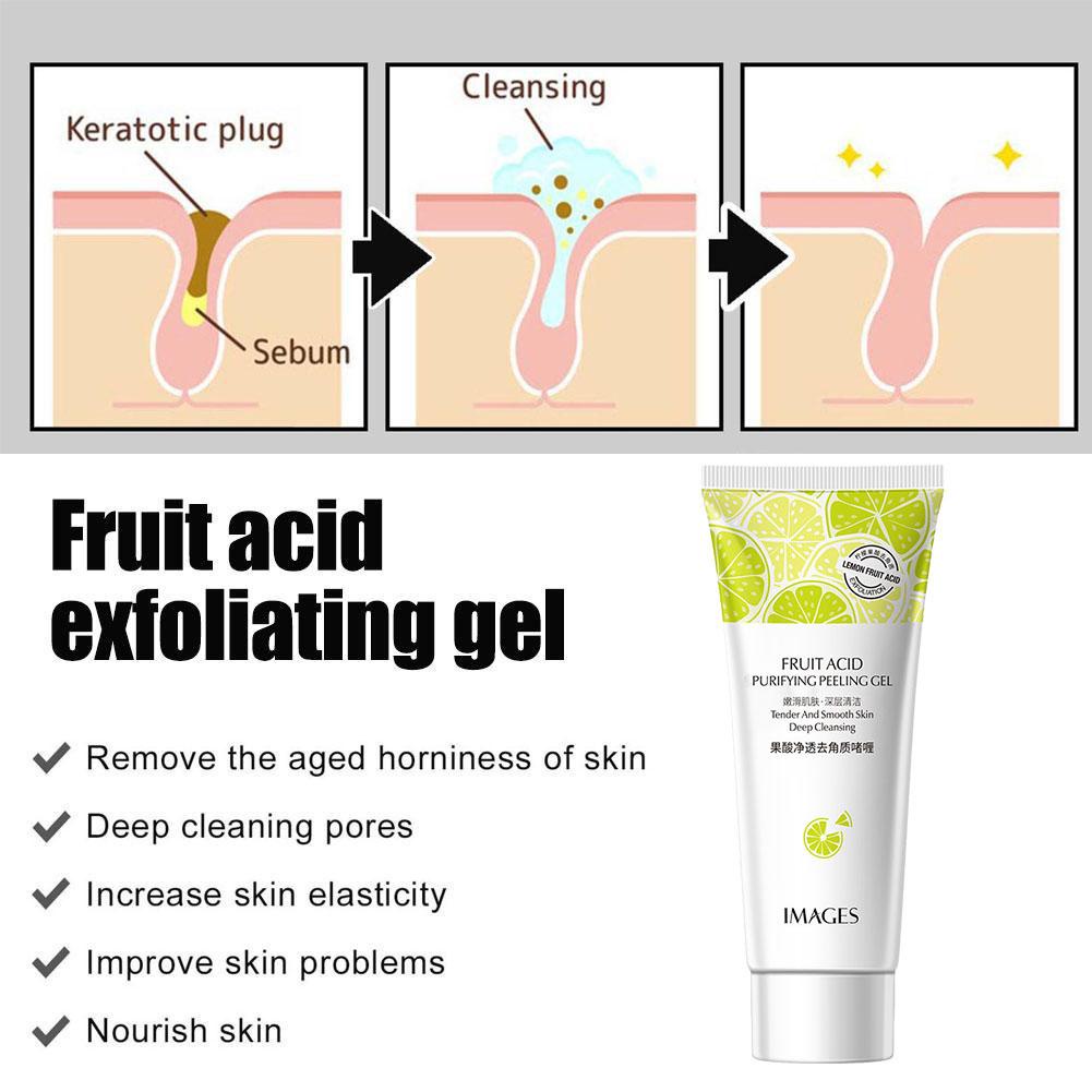 Axit Trái Cây Tẩy Tế Bào Chết Da Mặt Gel 50G Cho Hồng Làm Trắng Da Mặt 80G Da Mặt Tẩy Tế Bào Chết Toàn Thân Sữa Sâu Làm Trắng Da AubessDS
