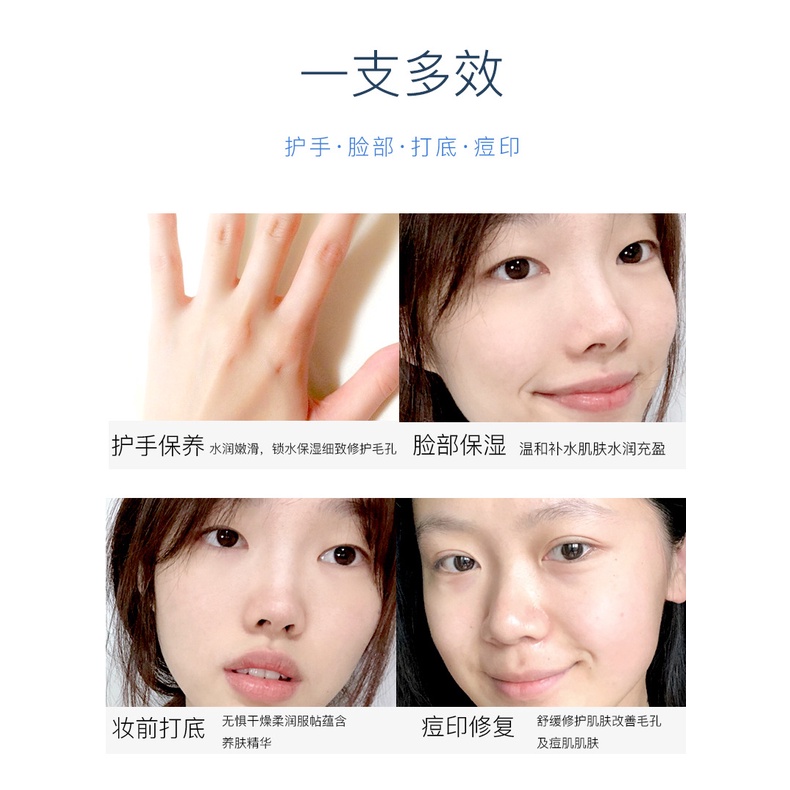 Kem Dưỡng Da Tay hyaluronic acid Dưỡng Ẩm Chống Nứt Nẻ 40g