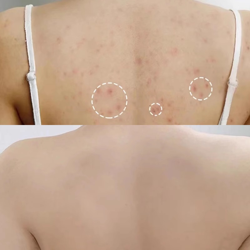 Xà Phòng Tinh Chất Trái Đào Nhật Bản 135g Giúp Hỗ trợ giảm mụn Lưng