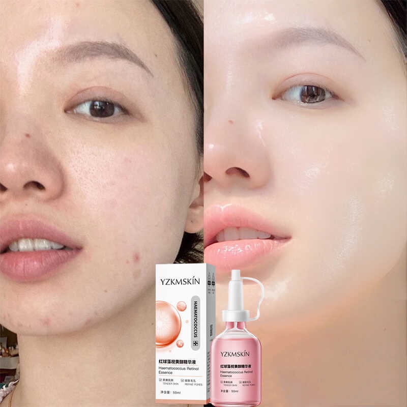 Yzkmskin serum Haematococus retinol retinol Se Khít Lỗ Chân Lông 50g Cải Thiện Nếp Nhăn Cho Da Mặt