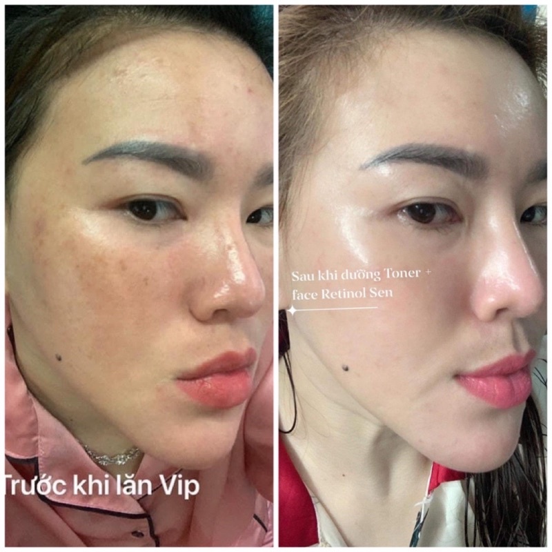 Toner Rau Má SEN Nước Hoa Hồng Cân Bằng Ẩm Trẻ Hoá Căng Bóng Da Dược Phẩm Mỹ Phẩm Sen