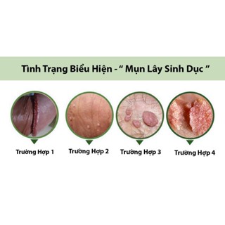 Serum thổi bay sùi mào gà,gai sinh duc