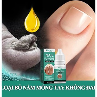 Serum loại bỏ nấm móng Tinh chất phục hồi móng 10ml Serum phục hồi móng Móng kháng khuẩn chân loại nấm móng gãy