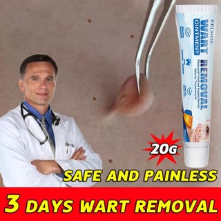 Wart Remoal Cream Tẩy nốt ruồi kem bôi rụng hết sạch mụn thịt thừa, mụn cóc, mụn nốt duồi và các mụn li ti quanh mắt