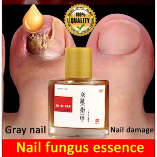 Tinh chất hỗ trợ cải thiện tình trạng nấm móng tay 100% chính hãng