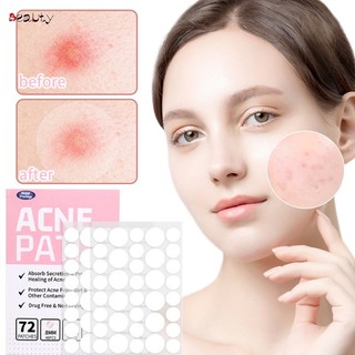 Set 24 / 36 / 72 miếng dán hỗ trợ giảm mụn ngày / đêm tiện dụng
