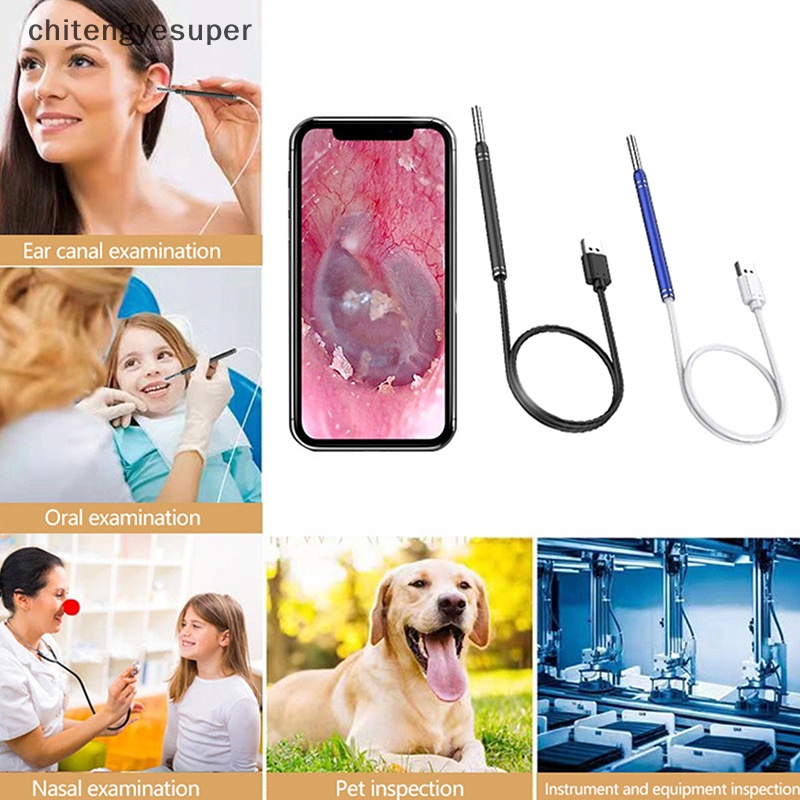 1 Bộ Dụng Cụ Lấy Ráy Tai Thông Minh Quan Sát Ráy Tai