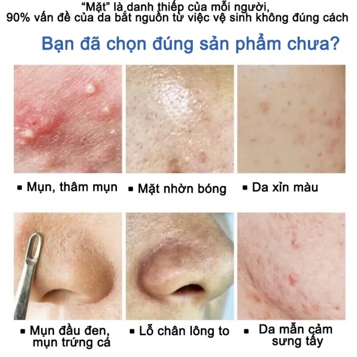 (160g) Sữa Rửa Mặt Da Dầu Mụn Cho Nam Ngừa Mụn Làm Trắng Da Dưỡng Ẩm Thành phần tự nhiêndesigned for men