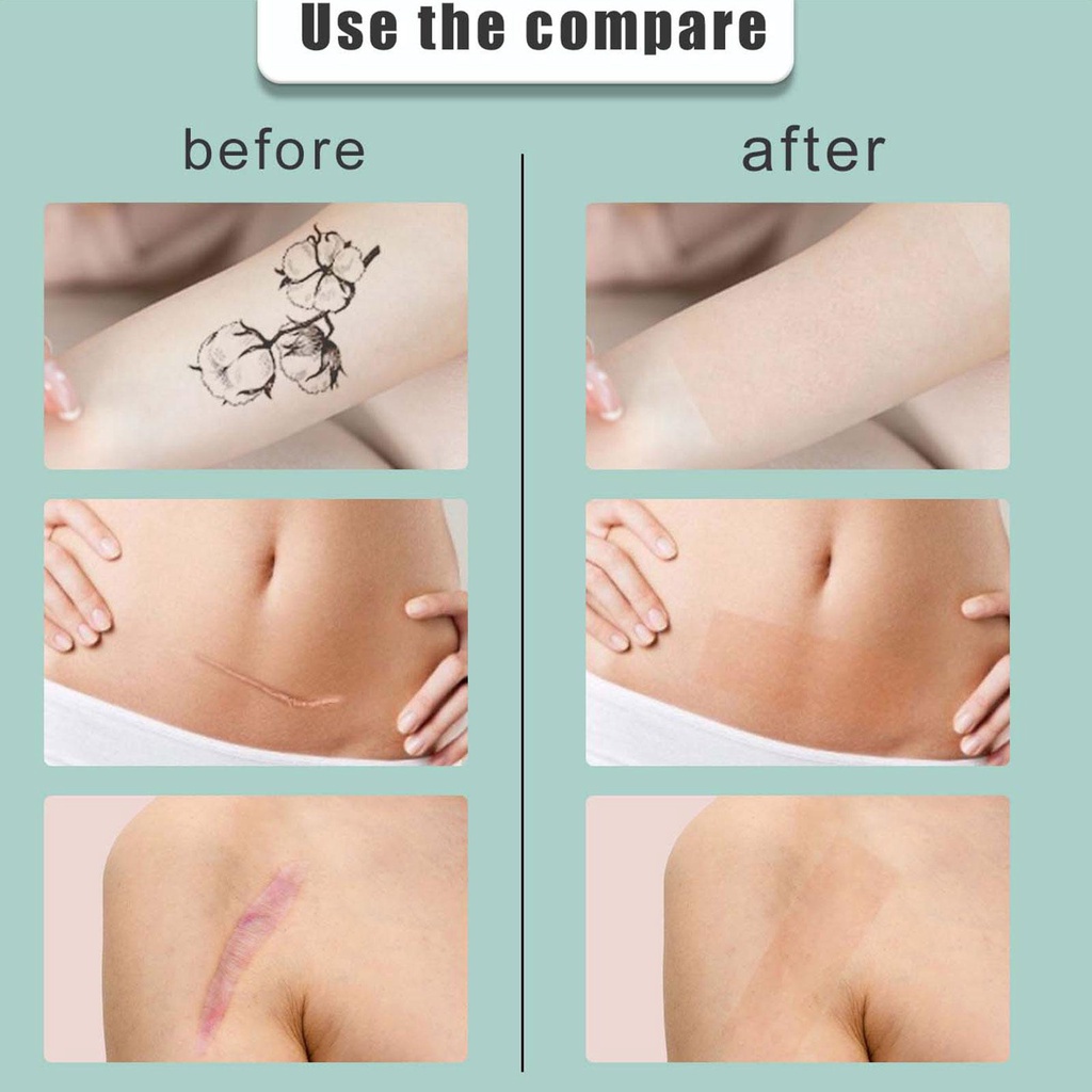 Miếng Dán Che Khuyết Điểm Che Phủ Hình Xăm Tự Dính o7e1